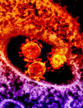 Colorful microscopic image depicting coronavirus particles in vibrant detail.